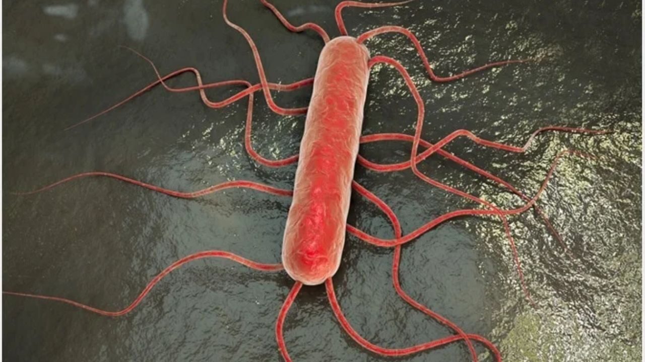 Listeriosis