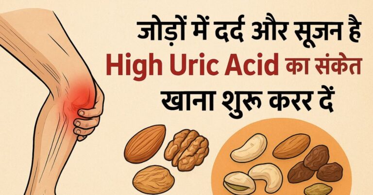 High Uric Acid