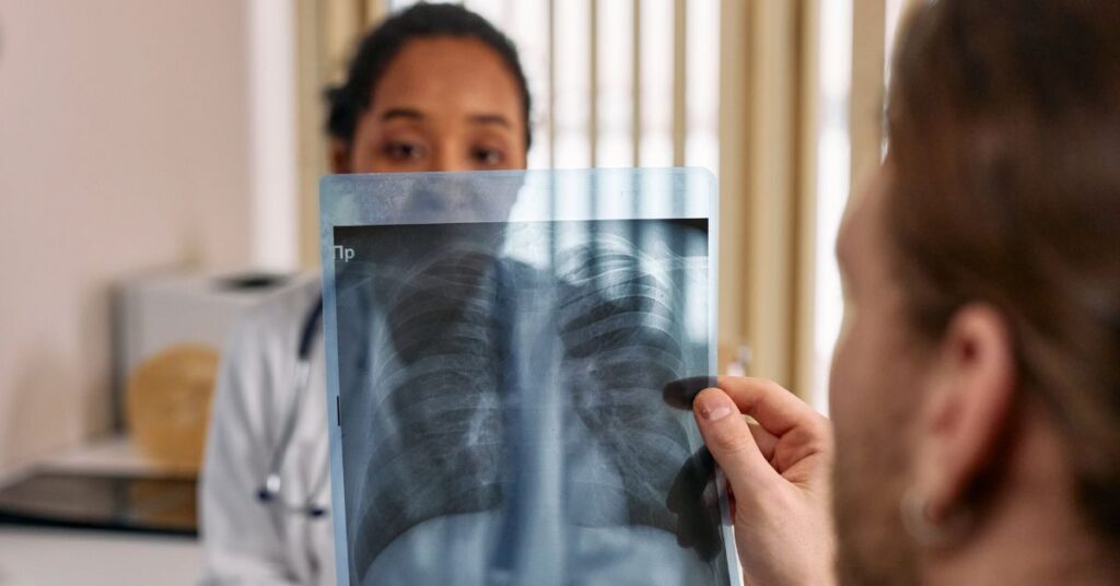 फेफड़ों के कैंसर